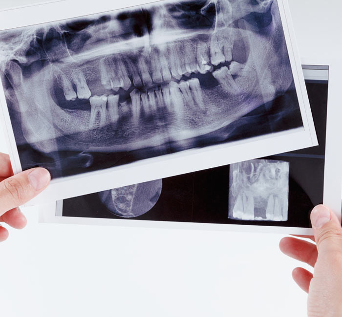 Radiographs (x-rays) - DEVON STREET DENTAL CLINIC