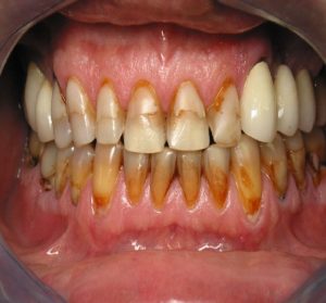teeth discolored conditions dental clinic toothaches